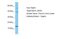 LRRC20 Antibody, Novus Biologicals 100 &mu;L | Buy Online | Novus Biologicals | Fisher Scientific
